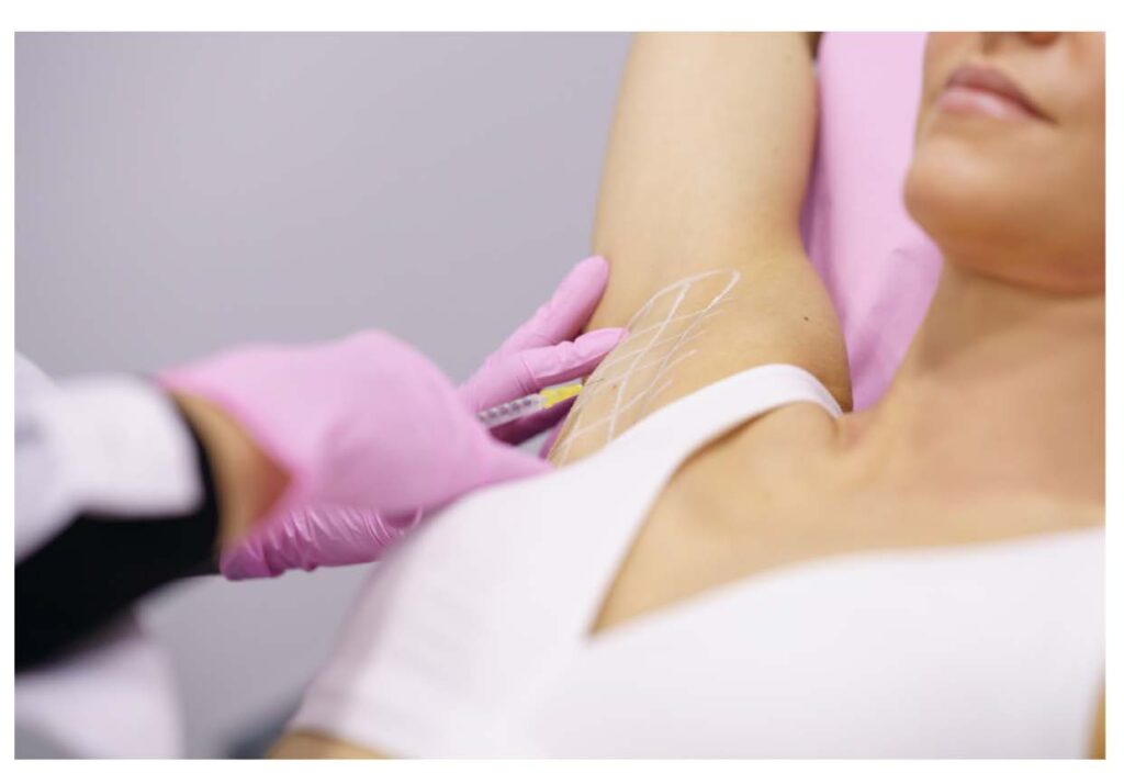 Botox is FDAS approved to treat severe cases
